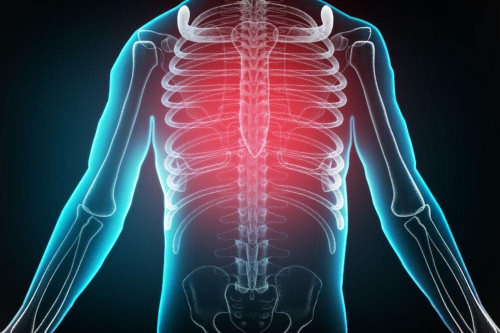 How Chiropractors Care for Broken, Bruised, or Separated Ribs