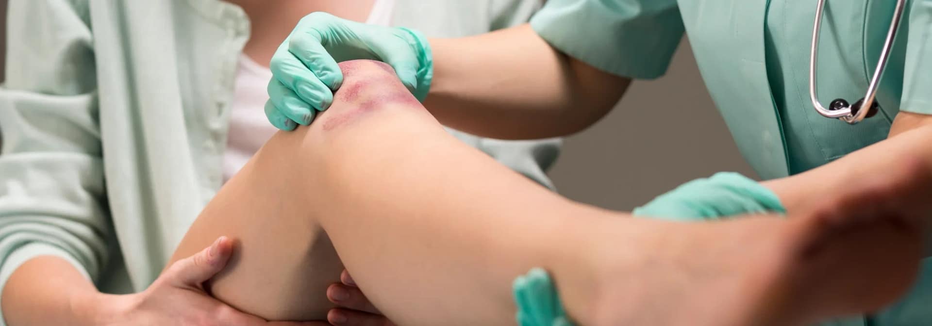 Checkup Knee Image
