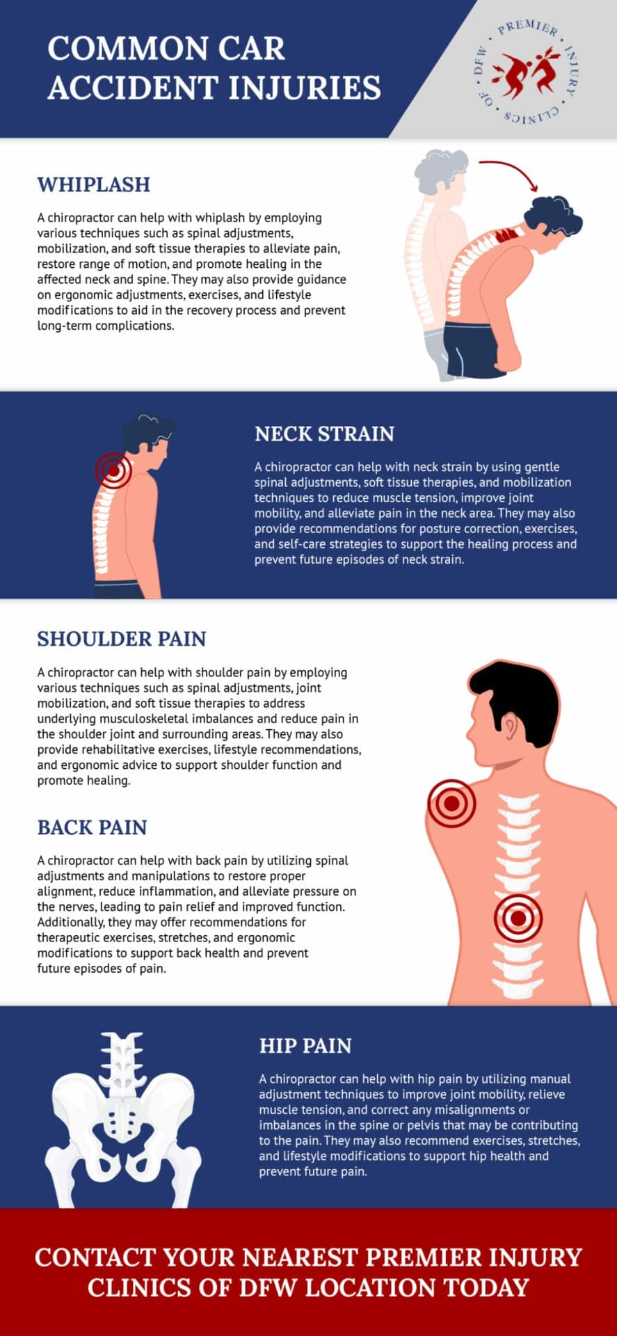 Lesiones comunes en accidentes automovilísticos, como el latigazo cervical, la distensión cervical, el dolor de hombro, el dolor de espalda y el dolor de cadera