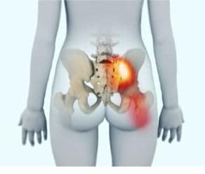 si joint pain exercises to avoid