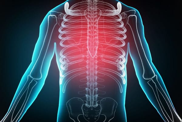 Cómo atienden los quiroprácticos las costillas rotas, magulladas o separadas