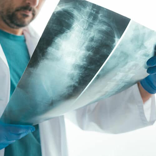 Spinal Xray
