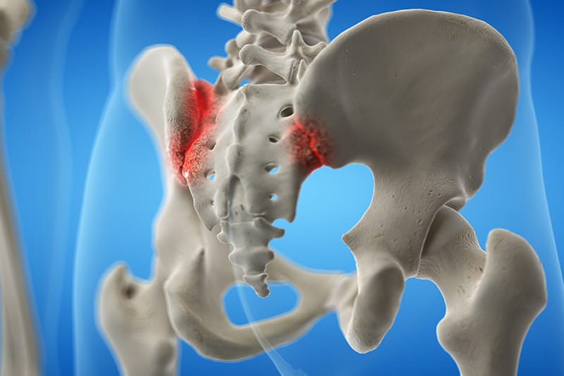 What is the Treatment for Sacroiliac Joint Pain
